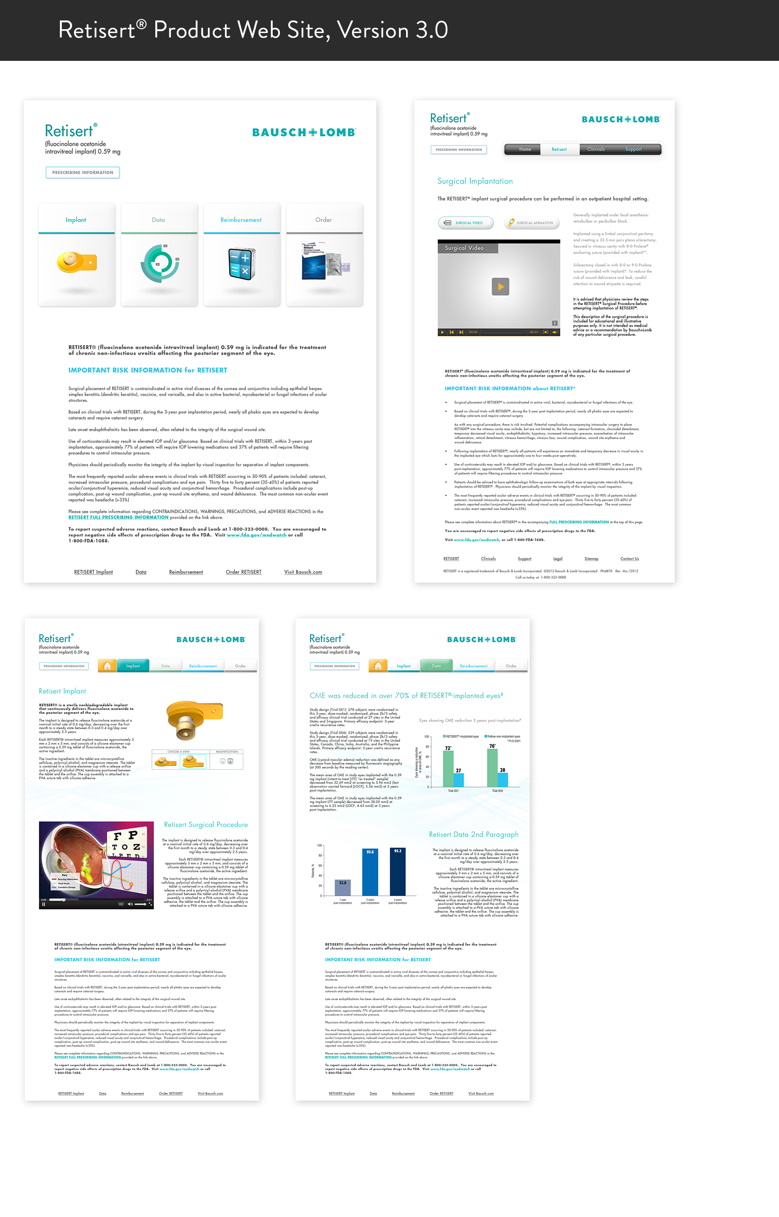 Case_Template_Bausch_04.png