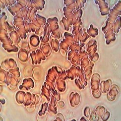 Live Blood Cells