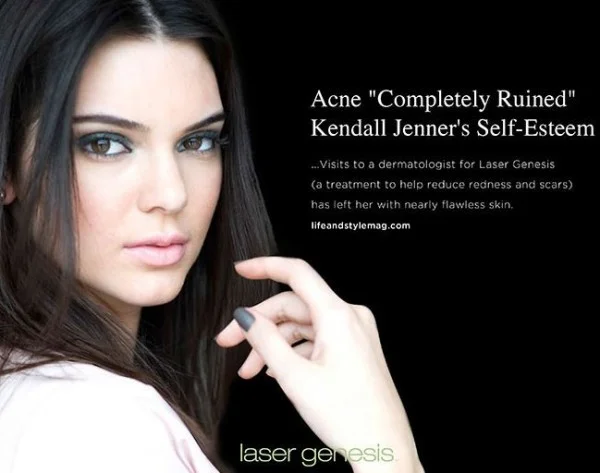Kendall-Jenner-600x473.jpg
