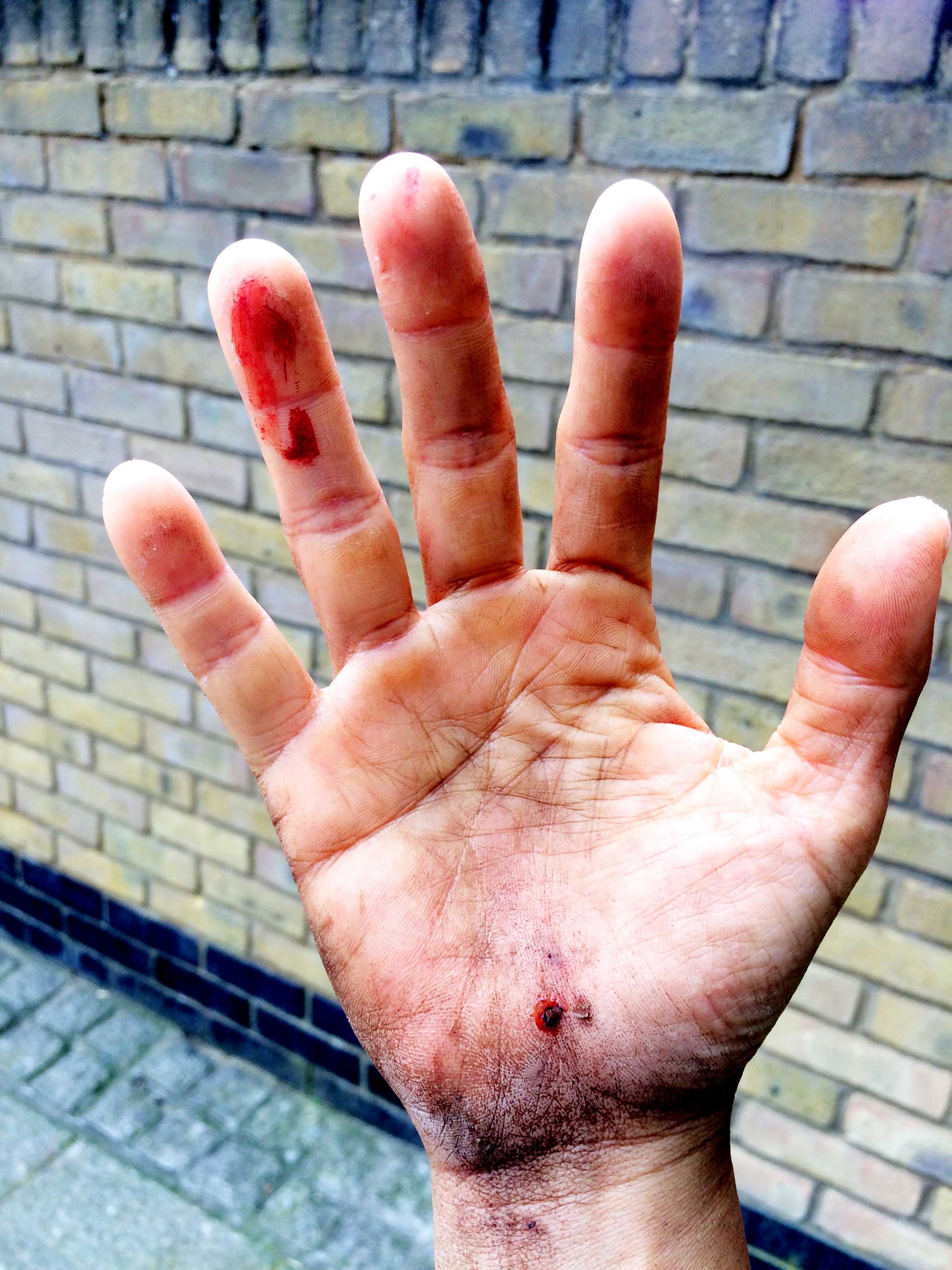 I used this scarred and bloodied picture of my palm when I fell and scratched myself during a run to illustrate that keeping our words do cause us something, sometimes it inconveniences us, sometimes it hurts our time, schedule or finances, but do it anyway. Your integrity is a virtue worth keeping.