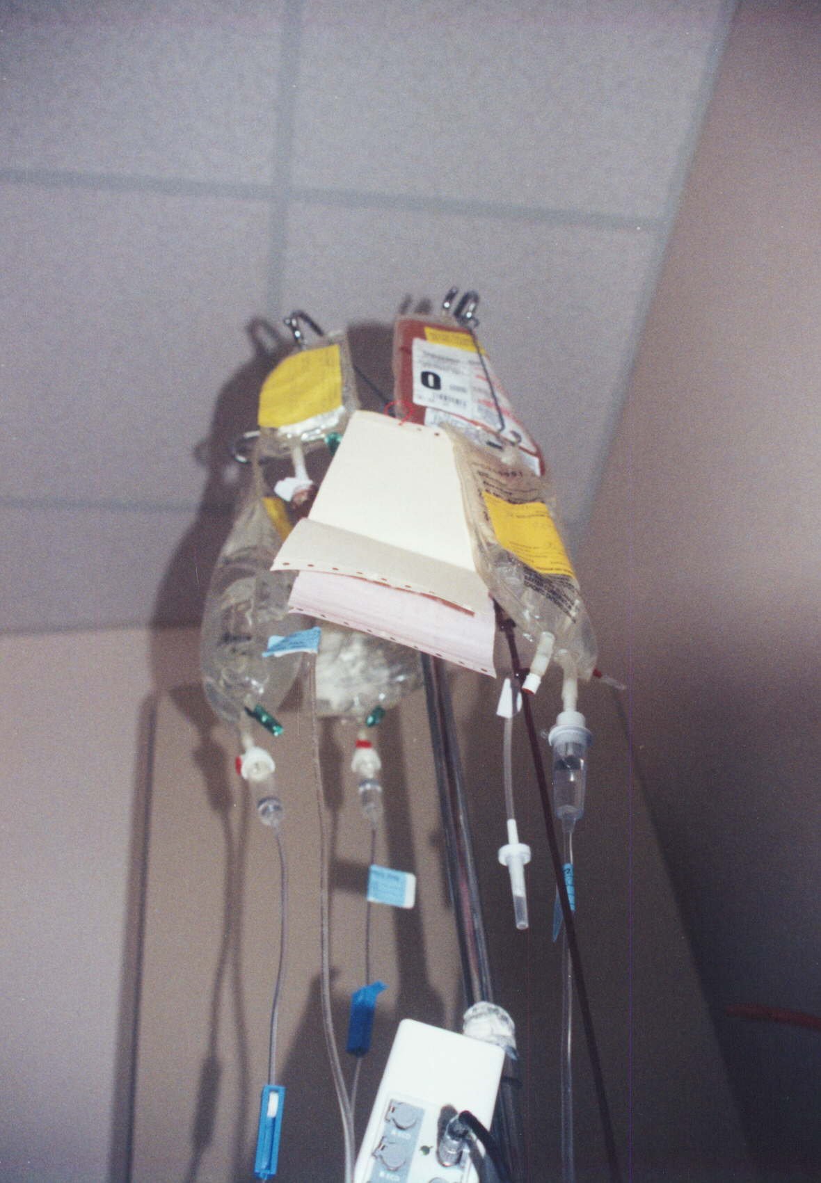 Early on during his first round of chemotherapy, Brendan was constantly connected to infusion pumps. For weeks at a time this was his view at the side of his bed. The chemo reduced his ability to produce blood cells so he had many, many blood and pl