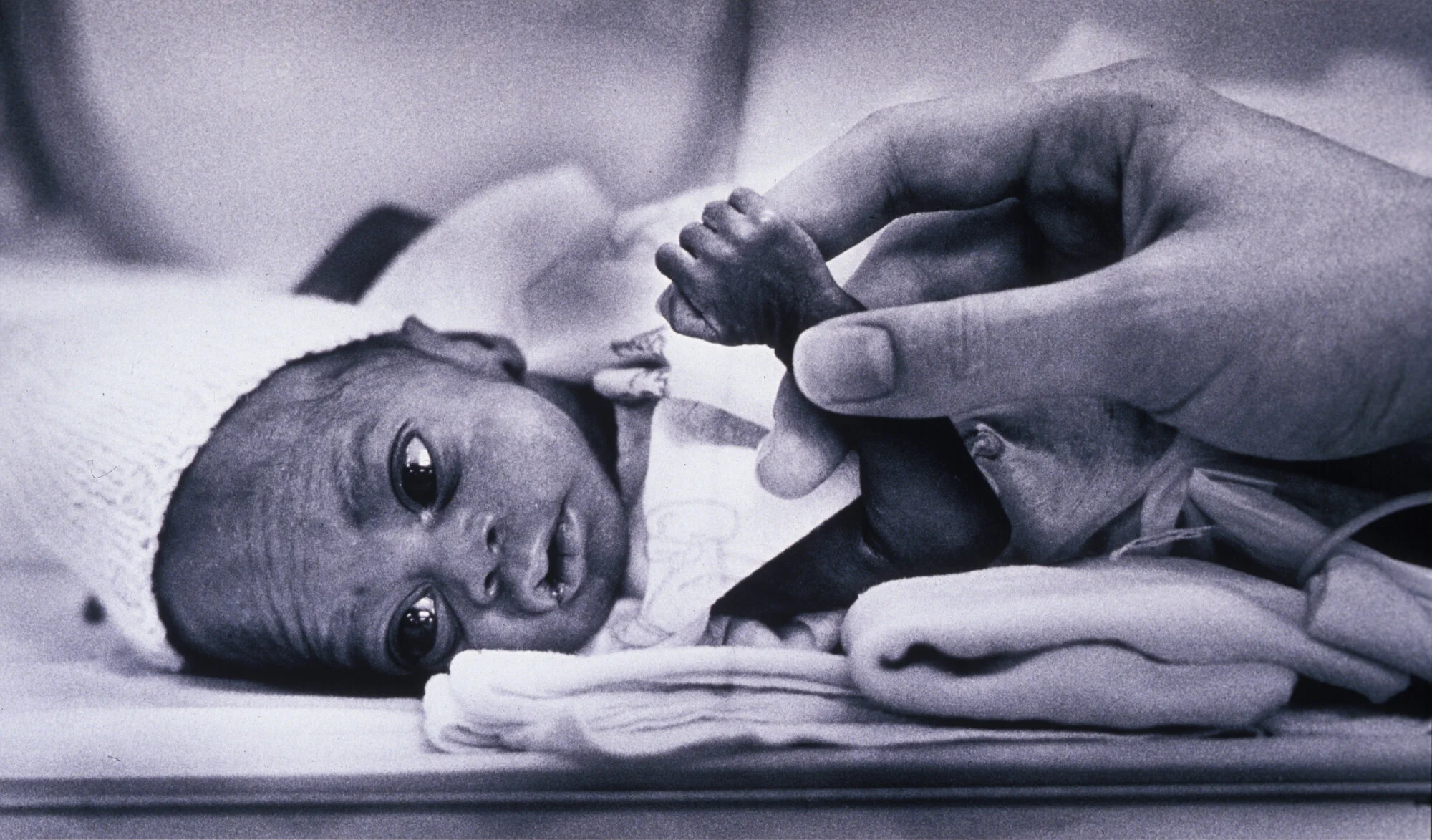  Jackson Memorial Hospital.  Neo Natal unit. 