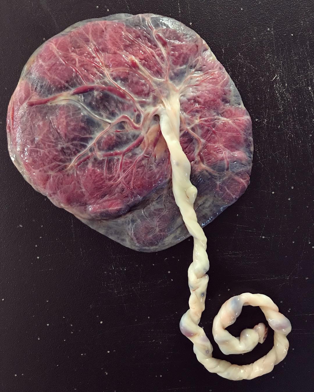 January has been the month of placentas! ✨🌀&hearts;️ I love how, just like our bodies and our babies, no two placentas are alike! Our bodies are amazing!  #placentaencapsulation #placentalove #placenta #placentaLA #informedWOMBan #informed #birth #d