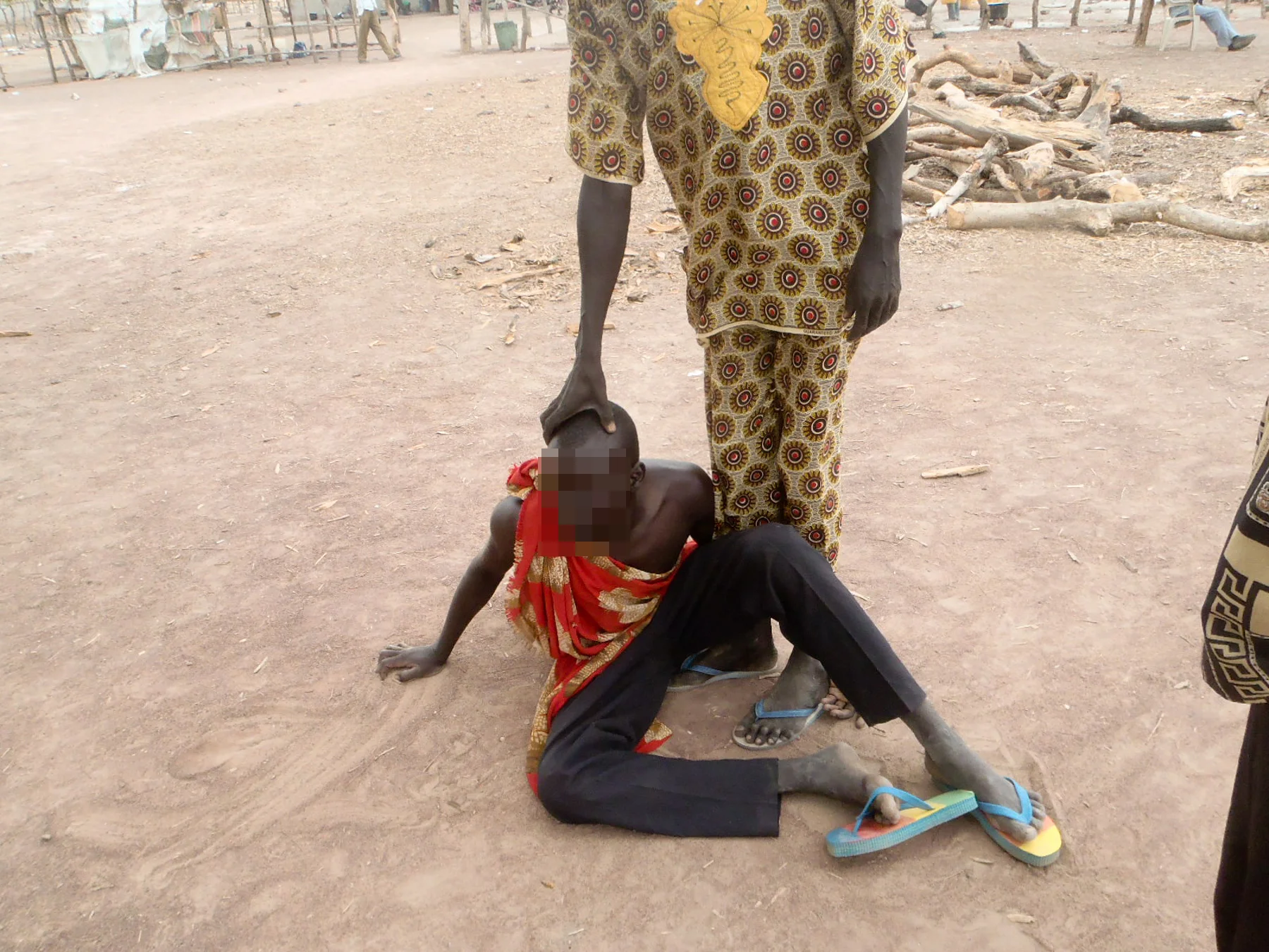 Ex child combatant Kuajok, South Sudan with undiagnosed psychological disorder