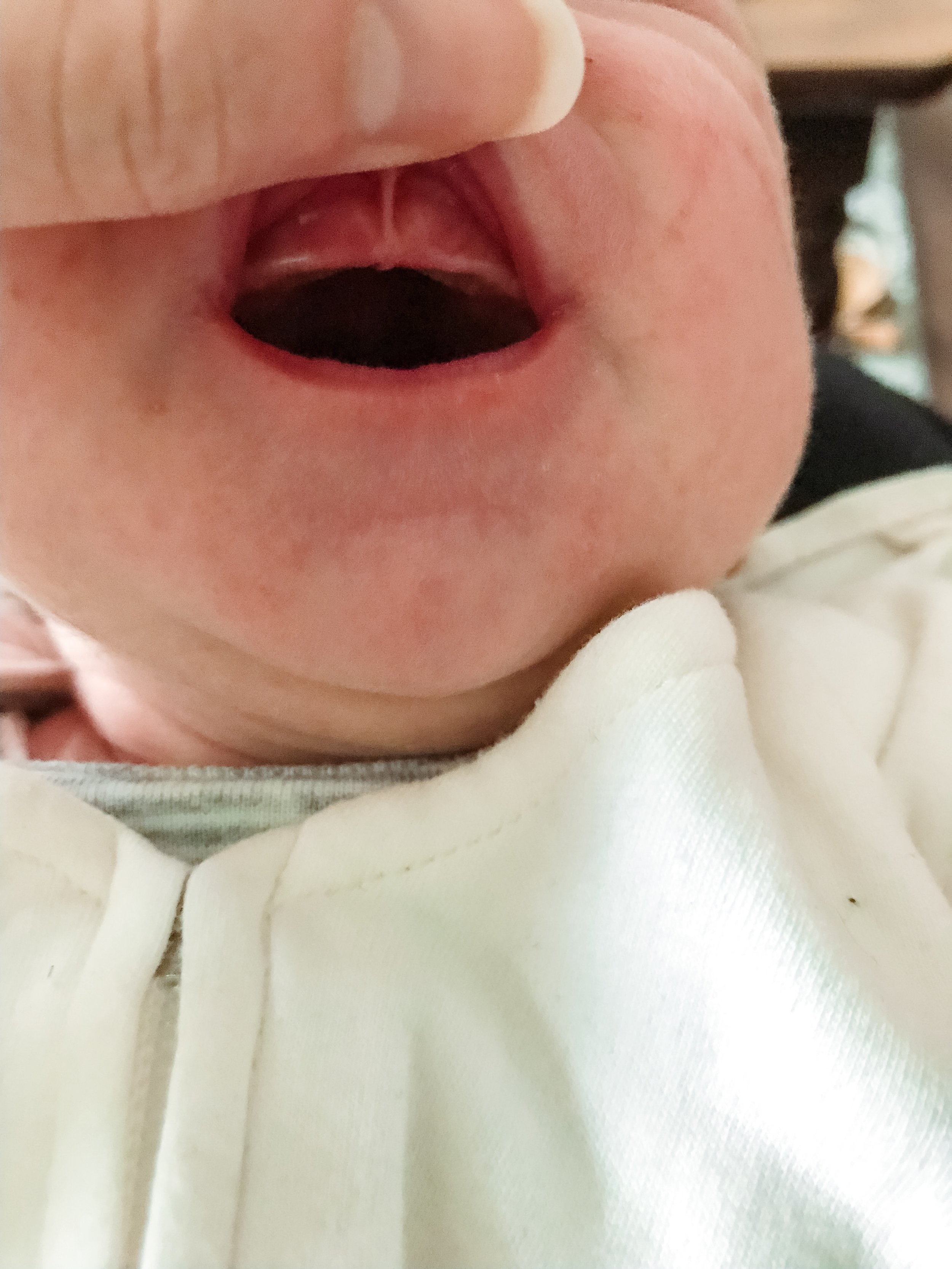 Is My Baby's Tongue Or Lip Tie Affecting Breastfeeding