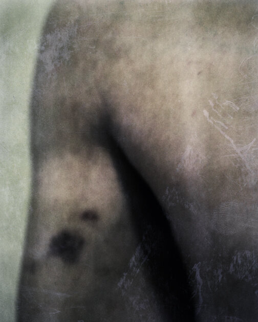 bruise_8x10.jpg