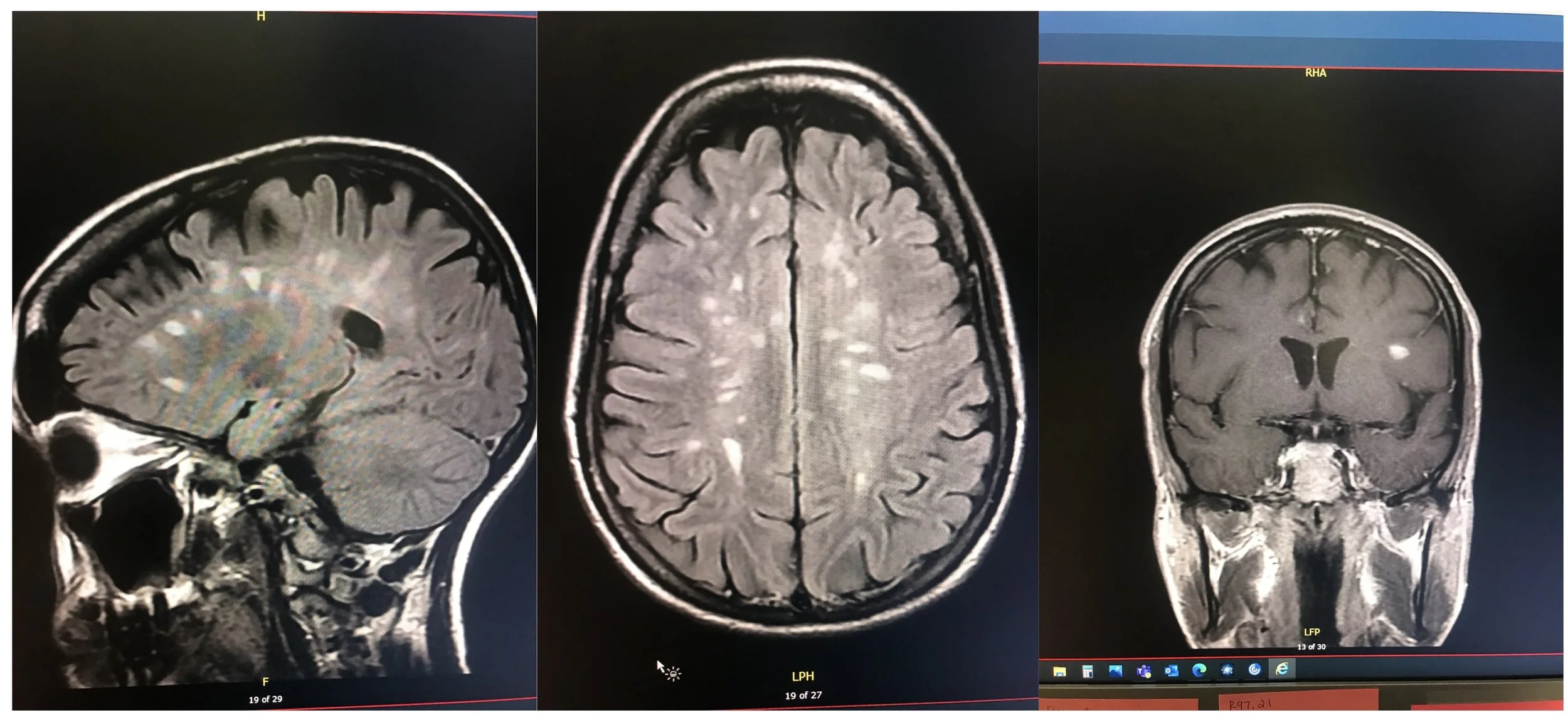Seeing God in My New Diagnosis