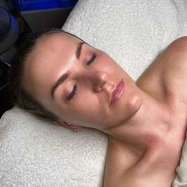 Monday mood ✨✨ Dewy and hydrated. I can&rsquo;t think of a better way to start the week , can you ? 🧖🏻&zwj;♀️✨ HydraFacial +dermaplane + LED = #hydrafacialmagic