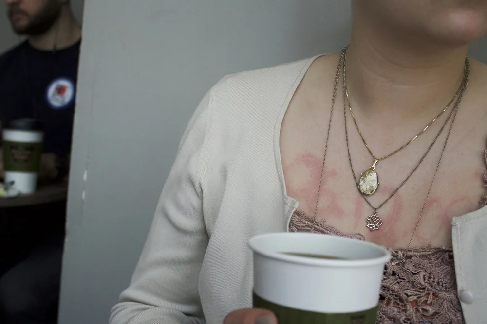 Exhibition: Artivism at Pollak Gallery