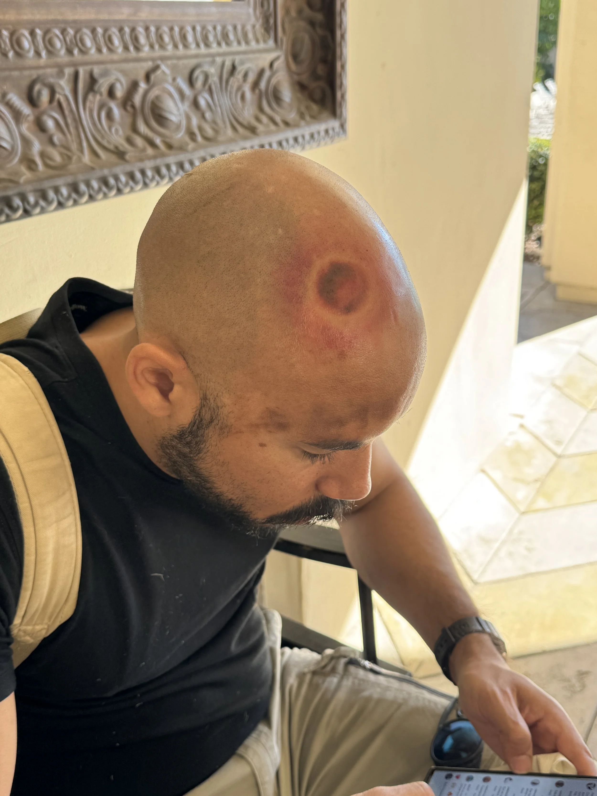 Coyote Blanco head wound.JPG