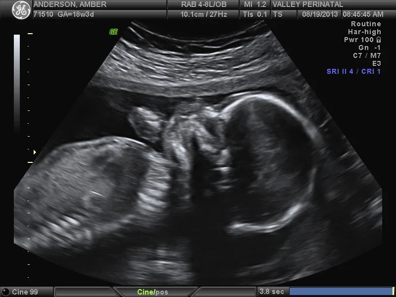 BABY_112.jpg