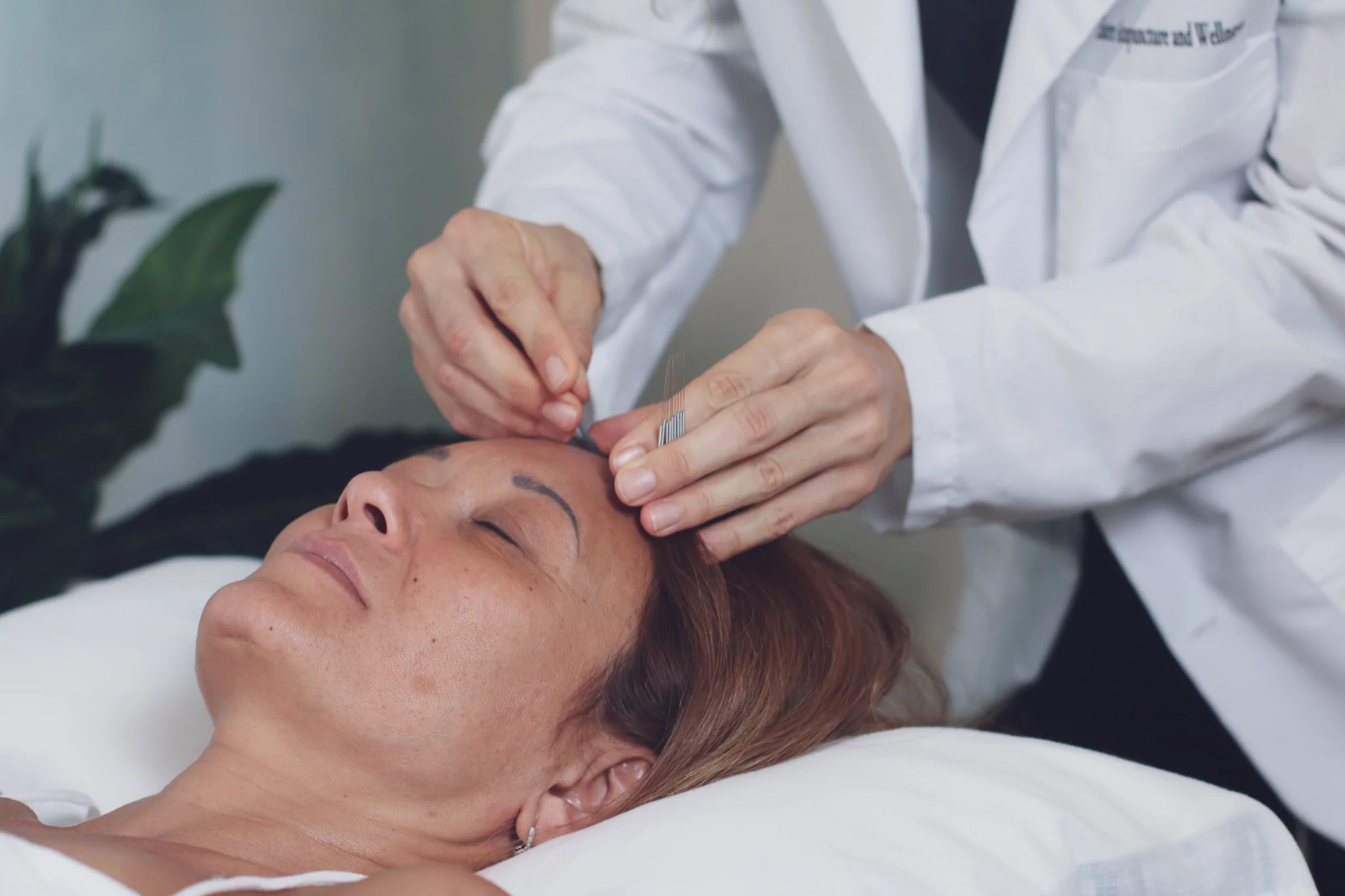 Acupuncture with Amanda of Eastern Acupuncture.jpg