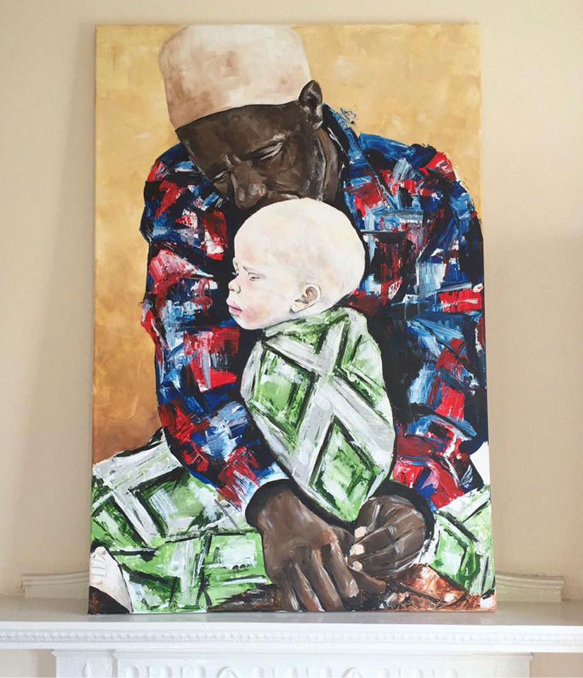 MAN&ALBINO.jpg