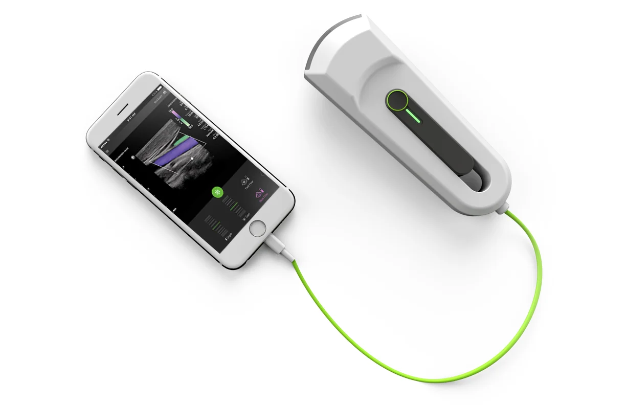 Ultrasound Render.80.jpg