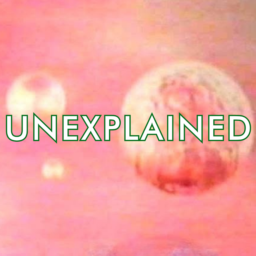 S09E30: Come, Hear What We Have to Say (The Scole Experiment), 2/2 episode artwork
