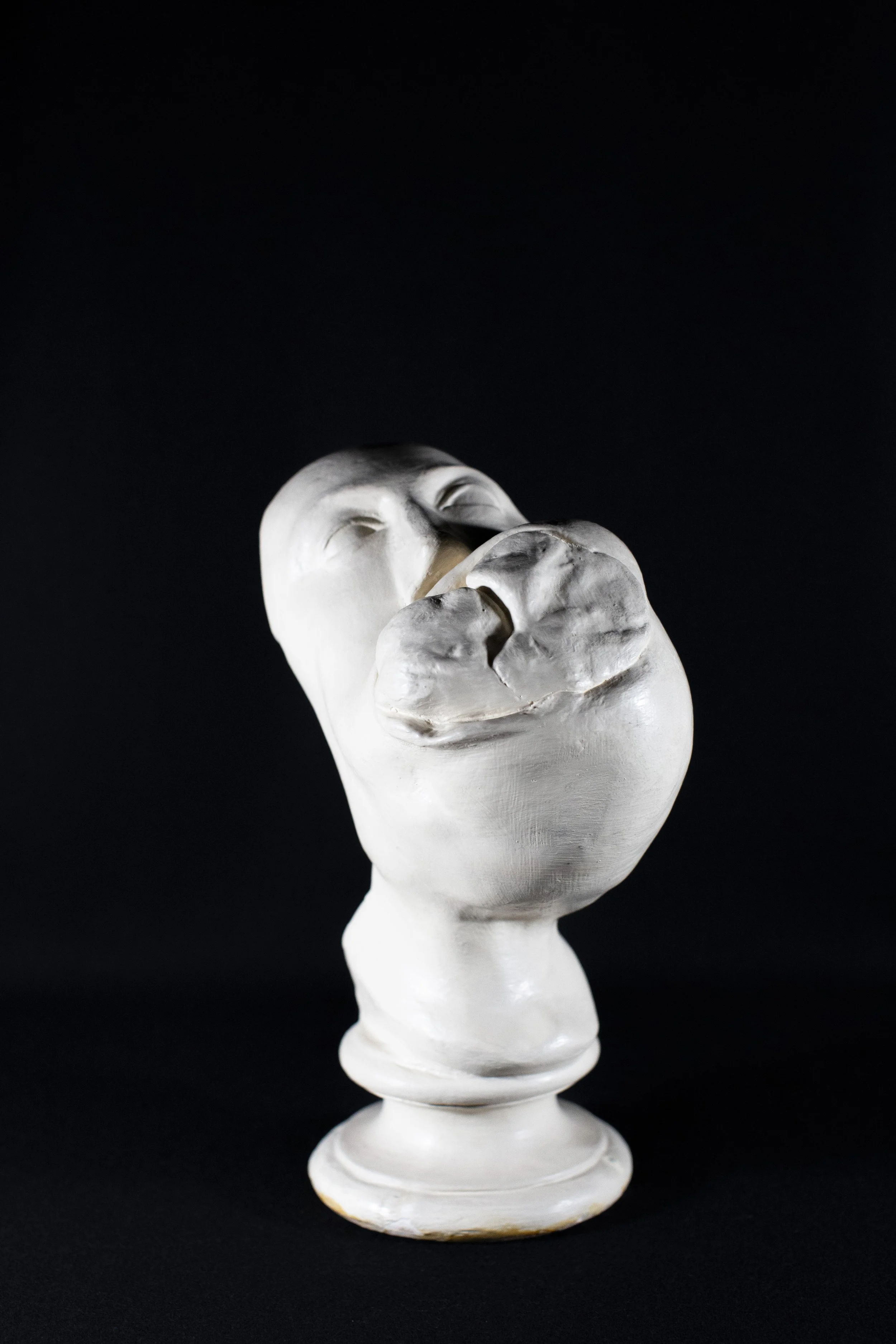 A model of Robert Penman’s jaw.