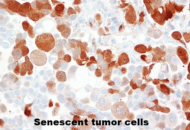 cell senescence.jpg