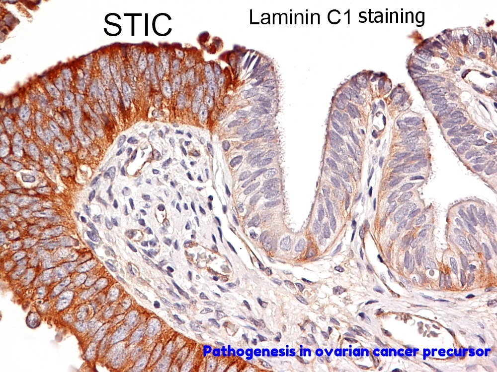 laminin STIC.jpg