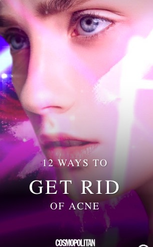 12 Ways to Get Rid of Acne