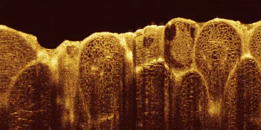 3D image stack of lemon pulp (≈8 x 8 x 4mm). Click to download video (15MB)