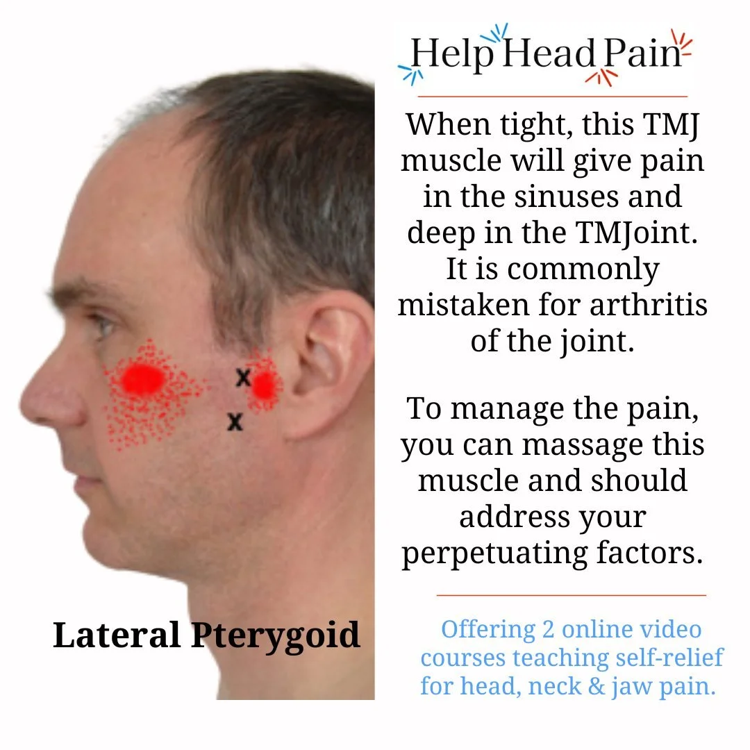 Did you know the lateral pterygoid muscle can create deep pain in the TMJ area that often feels like joint pain?

This small but powerful muscle helps open the jaw and guide jaw movement. When it develops trigger points, the symptoms can mimic TMJ ar