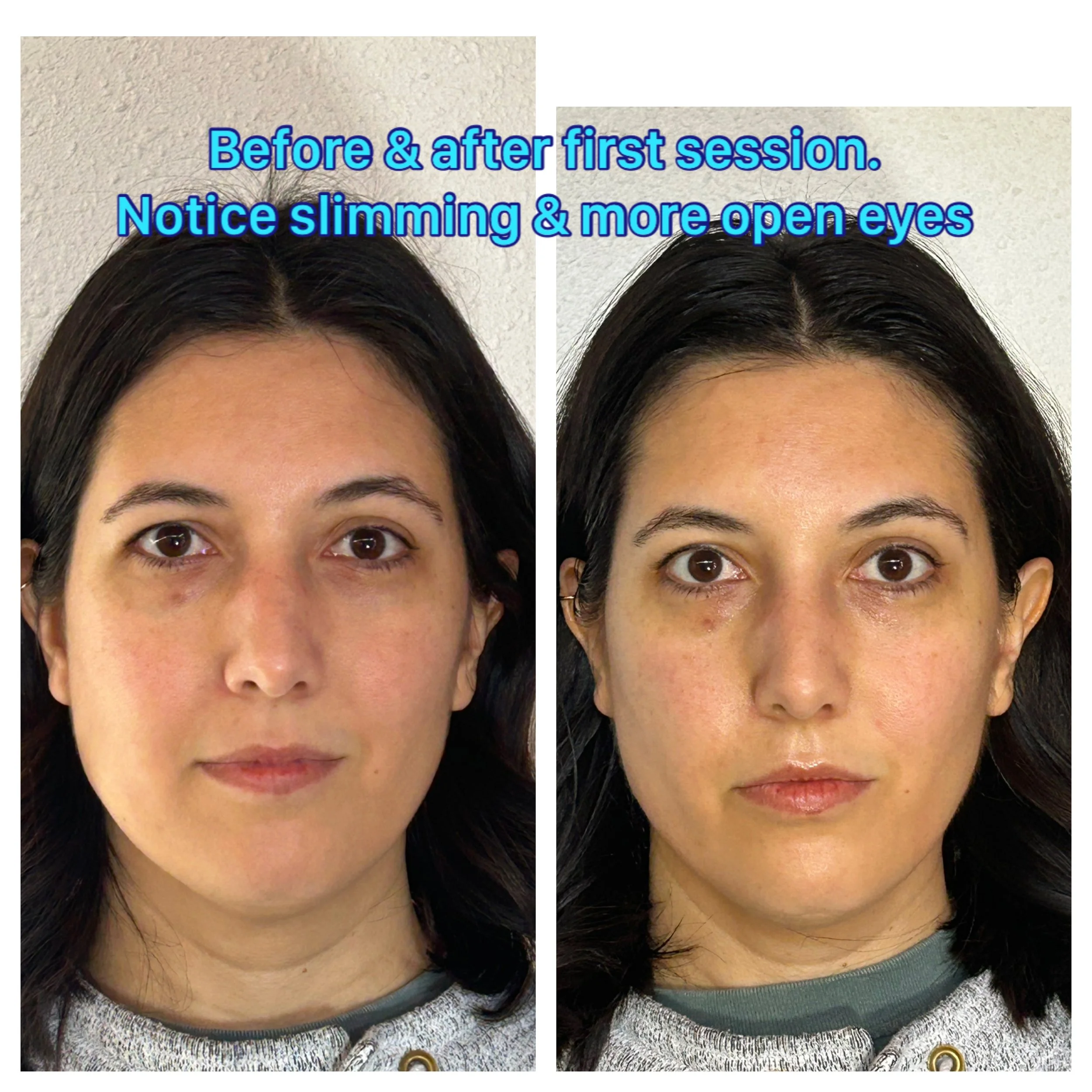 before & after buccal massage Austin