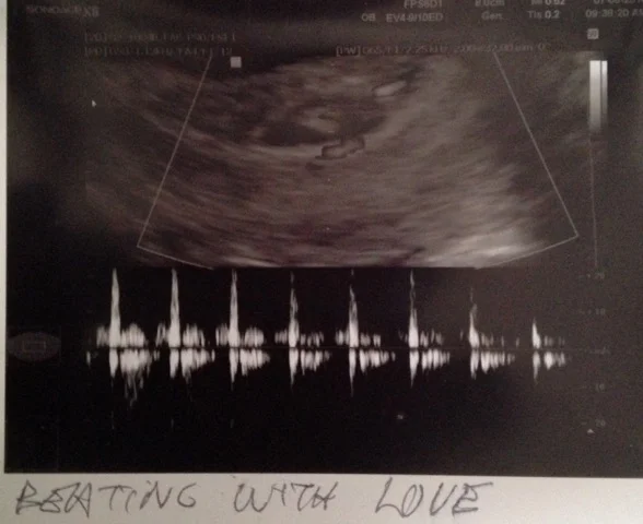 ultrasound.jpg