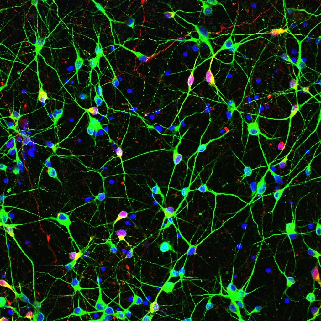 CAG180 MAP2 Calbindin 40X-2 Merge.jpg