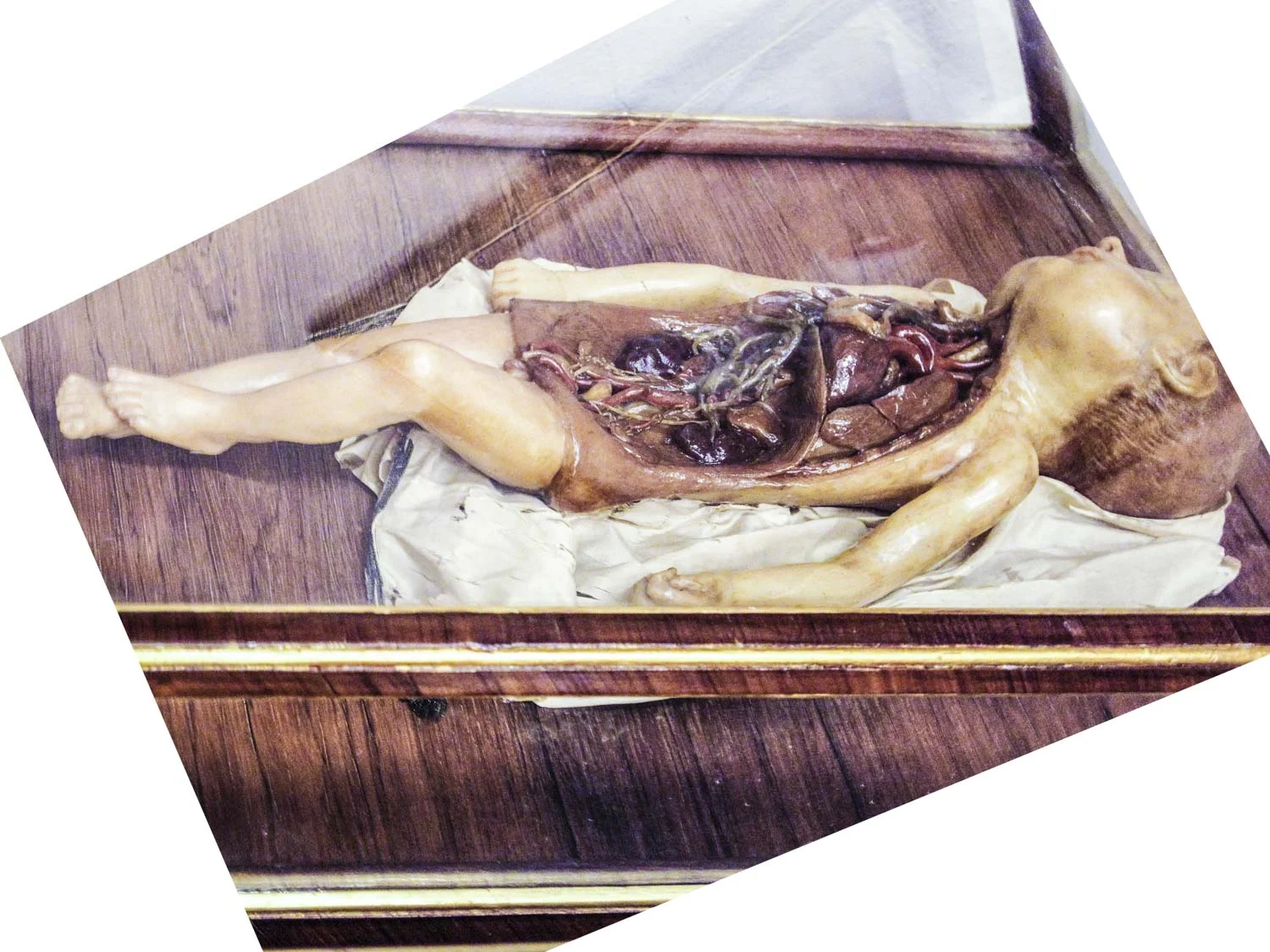 Fetus-HEYDT-SkinDeep.jpg