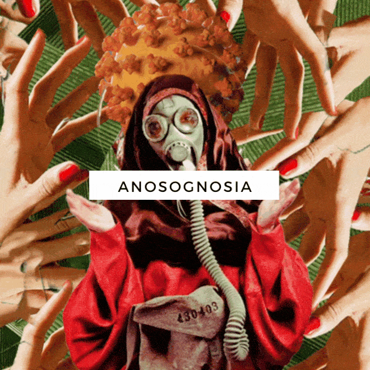 Anosognosia