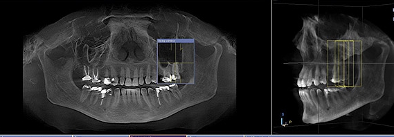 CBCT Scan Ballantyne Dentistry.jpeg