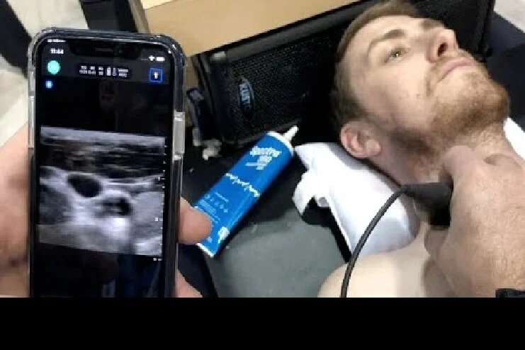 Point of CAre Ultrasound