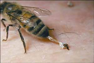 A worker bee leaving her stinger behind.