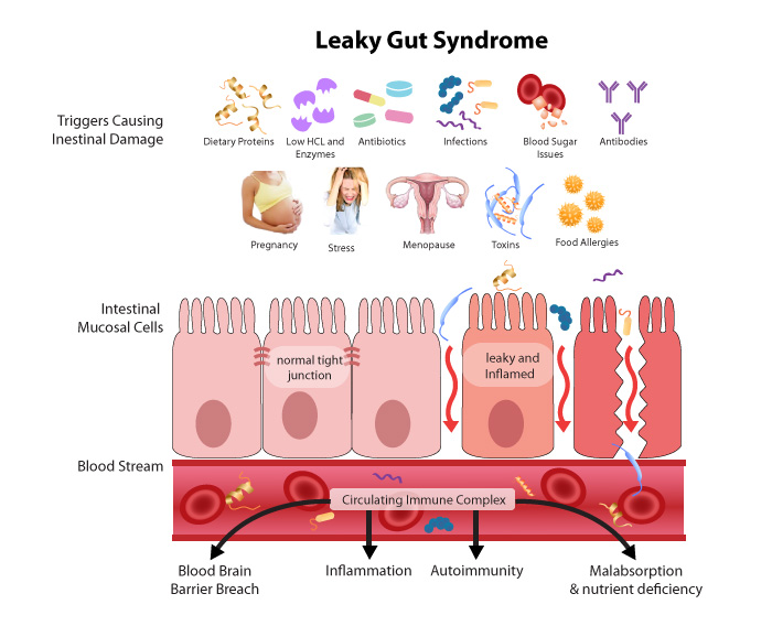 dysbiosis leaky gut