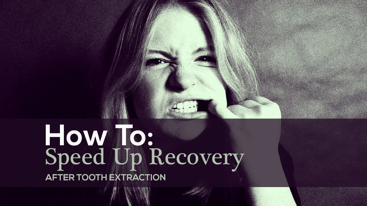 How to Speed Up Recovery after Tooth Extraction