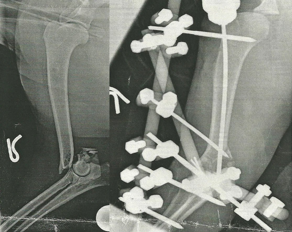 One of Leia's broke legs.