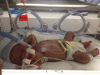 Josiah on the CPAP machine in his isolette-two holes for touching