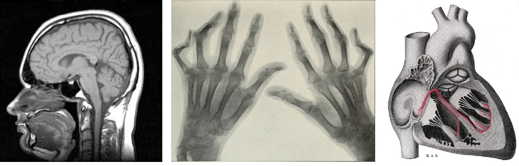 Images from internet Due to genetic and environmental factors, many chronic health issues such as depression, heart disease and arthritis disproportionately affect females as compared to males.