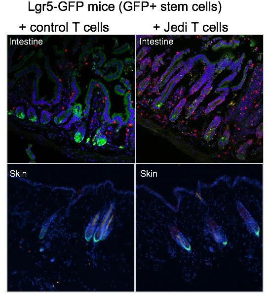 Images from Agudo et al. showing the Lgr5+ intestinal stem cells being cleared by the Jedi T cells but the Lgr5+ hair follicle stem cells being spared in the same mice.