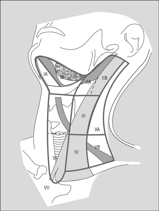 Figure 2. The levels and sublevels of the neck. Taken from: Consensus Statement on the Classification and Terminology of Neck Dissection, Arch Otolaryngol Head Neck Surg