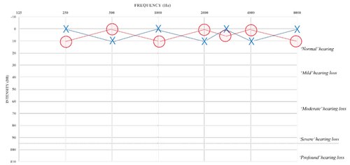 Audiometry — entsho.com
