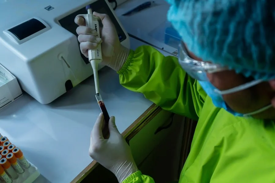 The Importance Of Antibody Testing For People Interested In Knowing The Past Exposure