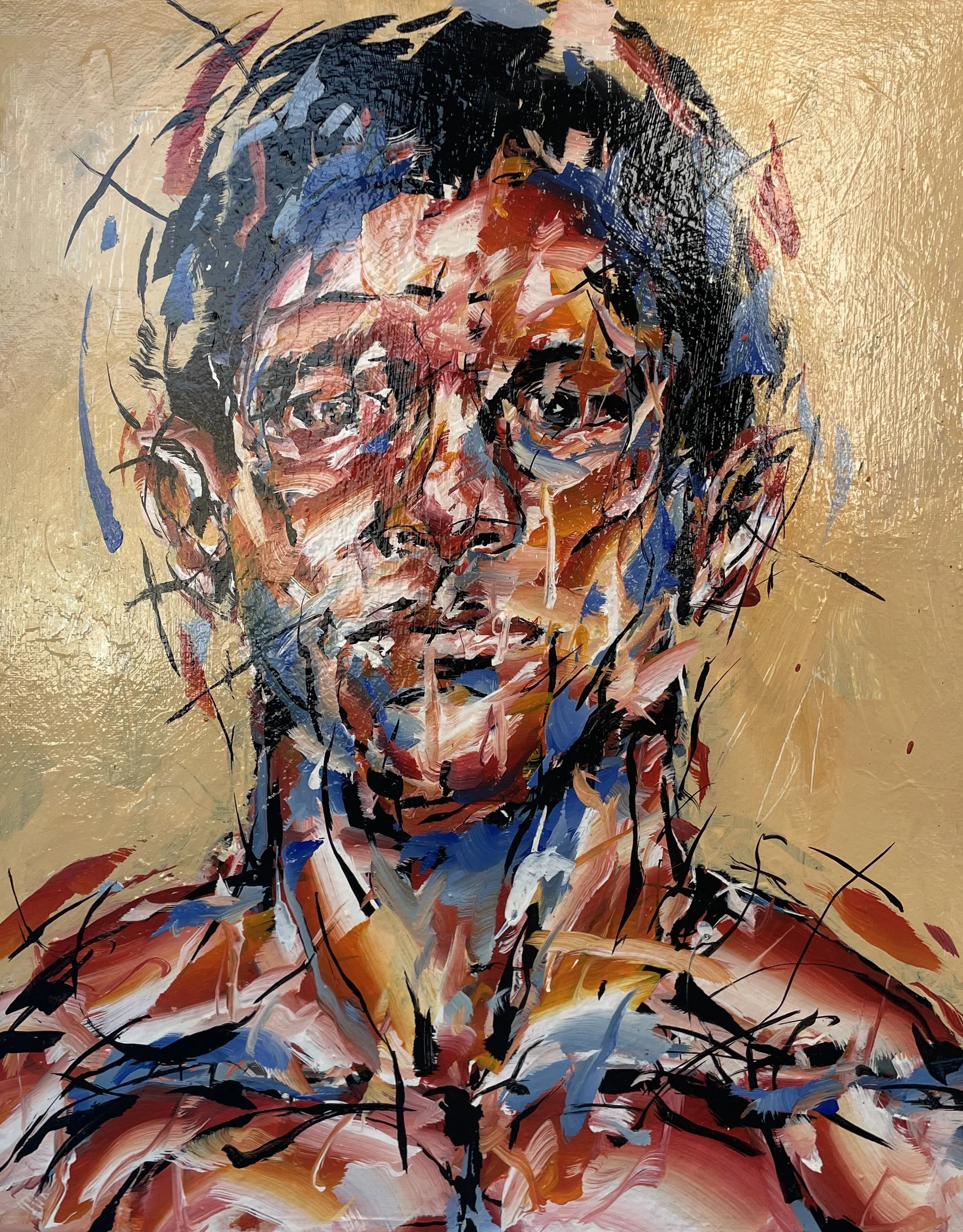 "Migraine Mondays" - $900