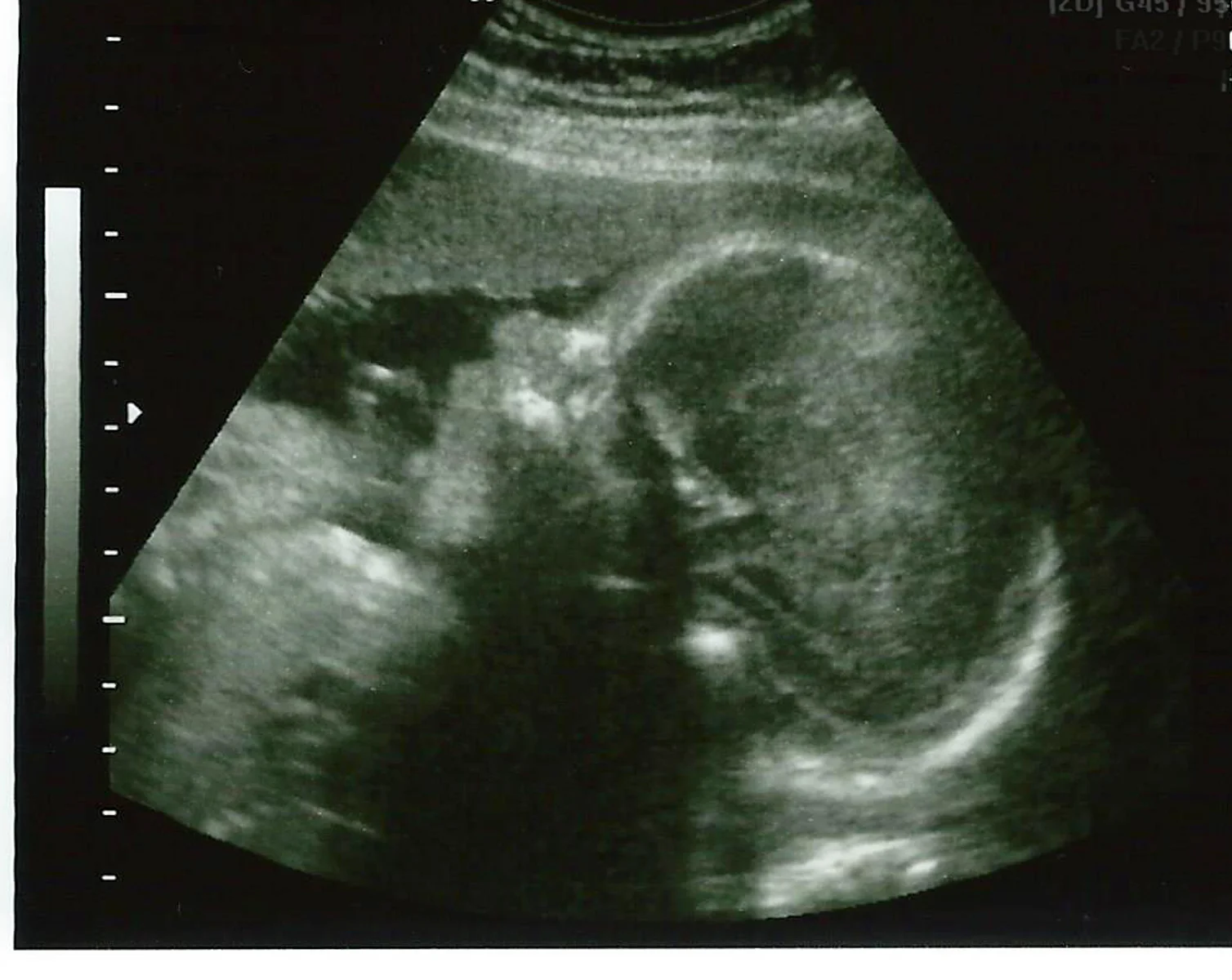 House Unanimously Passes Pro-life Bill Authored by Brown