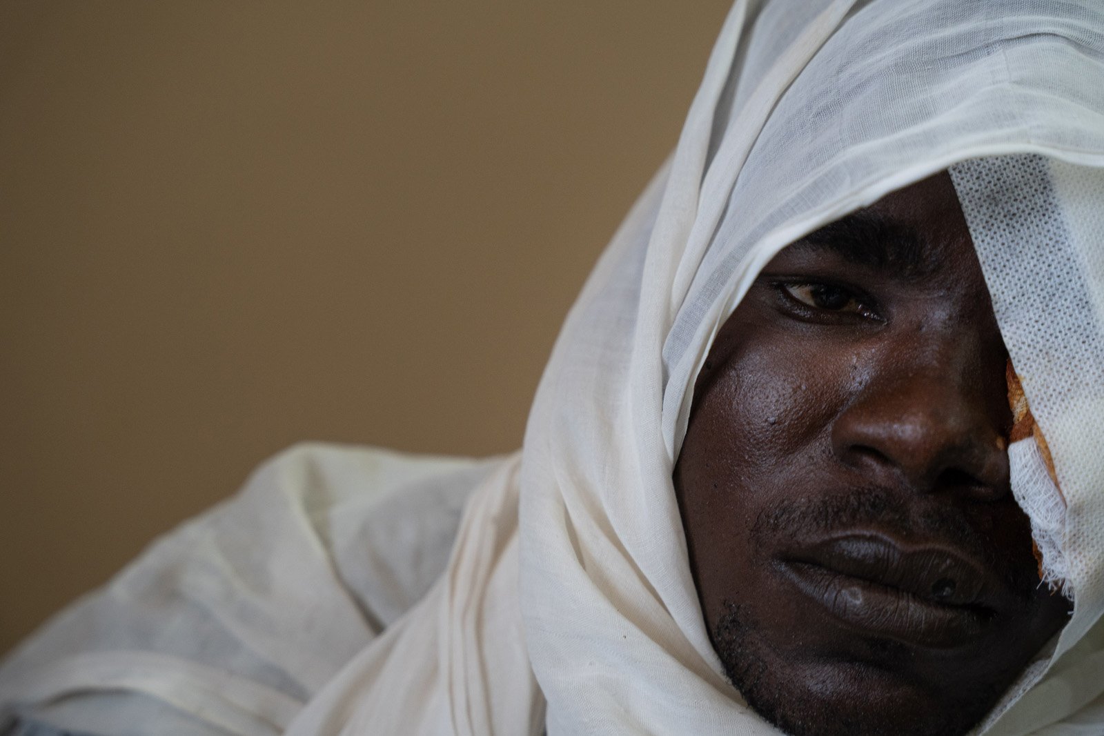  Osman Khatir, membre d'une tribu africaine, est hospitalisé à l'hôpital de Geneina après avoir recu une balle dans la tête lors d'une attaque de milices arabes dans les Jebel Moon. Geneina, 8 mars 2022 