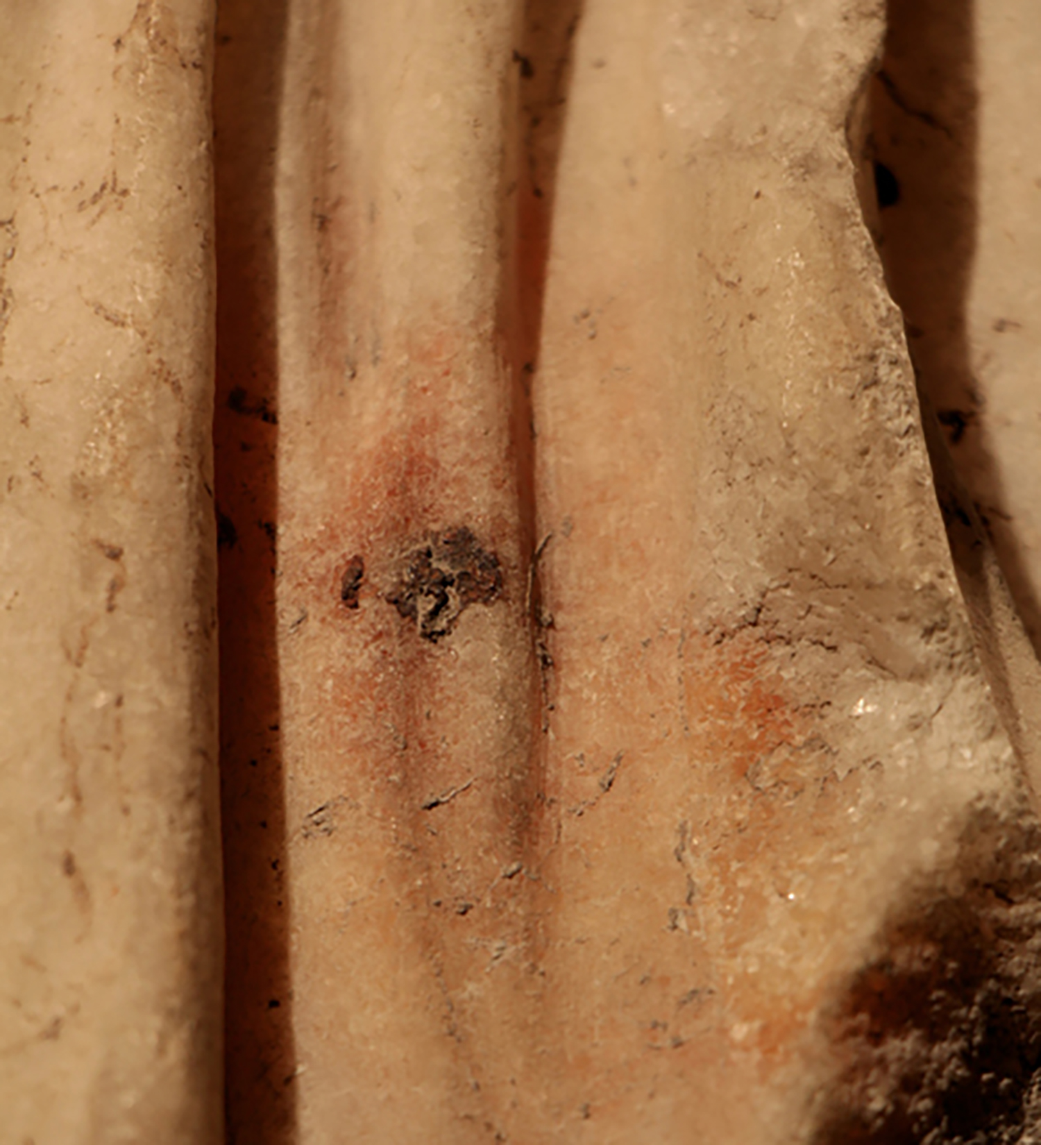 Figure 6: Discloration (Perhaps from Metal Object).
