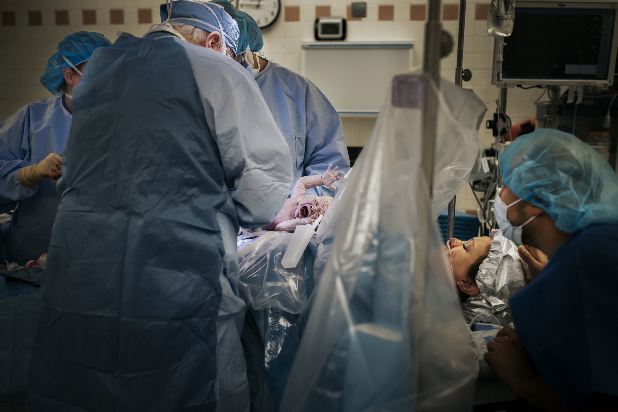 dfw cesarean birth photography