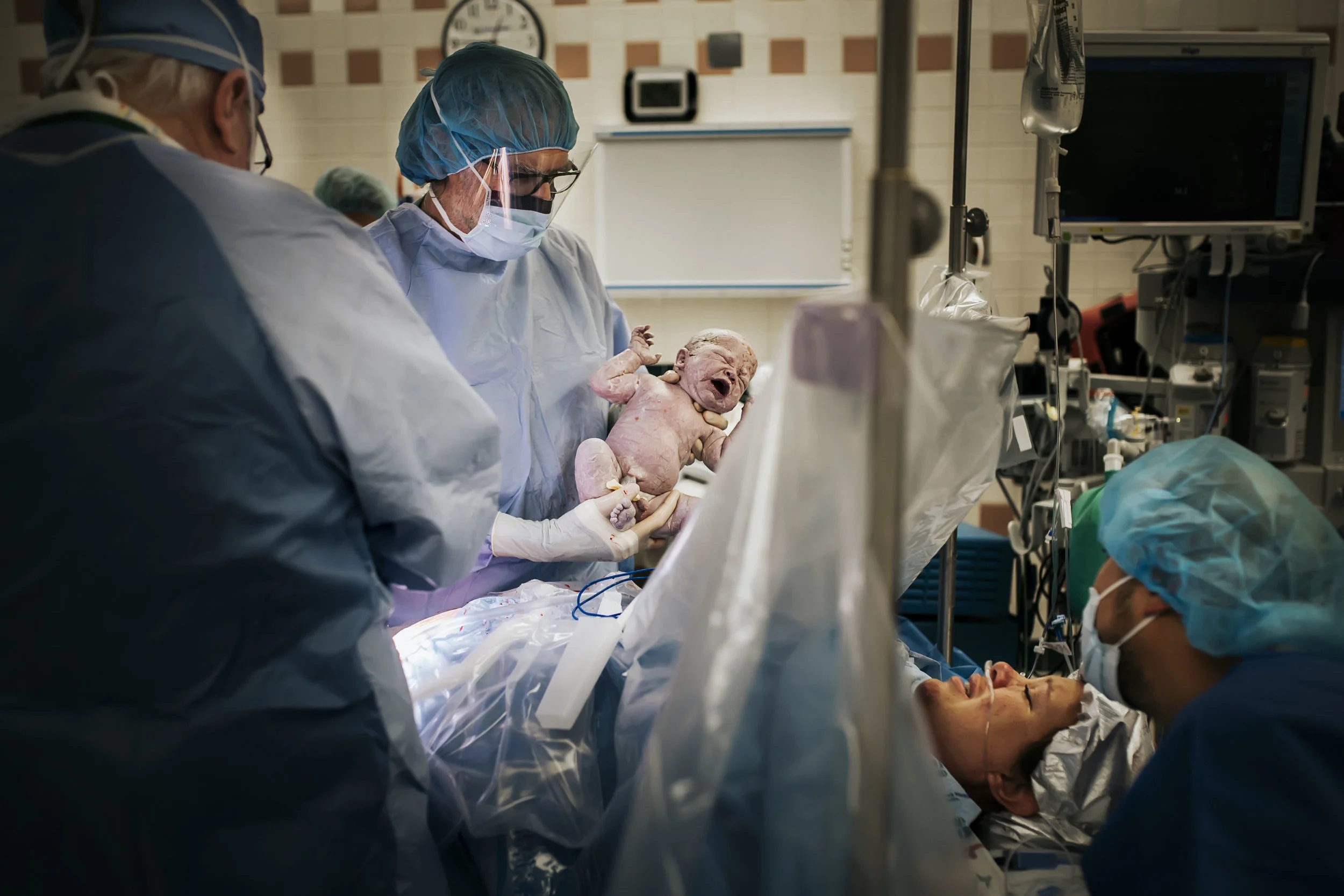fort worth cesarean birth photography