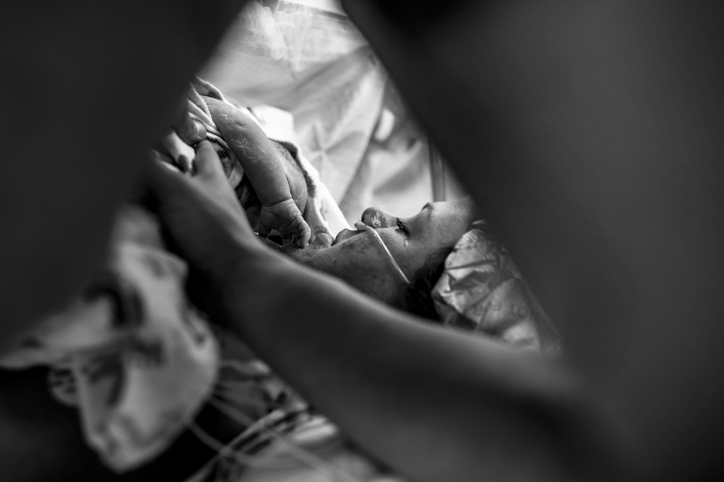 cesarean birth story