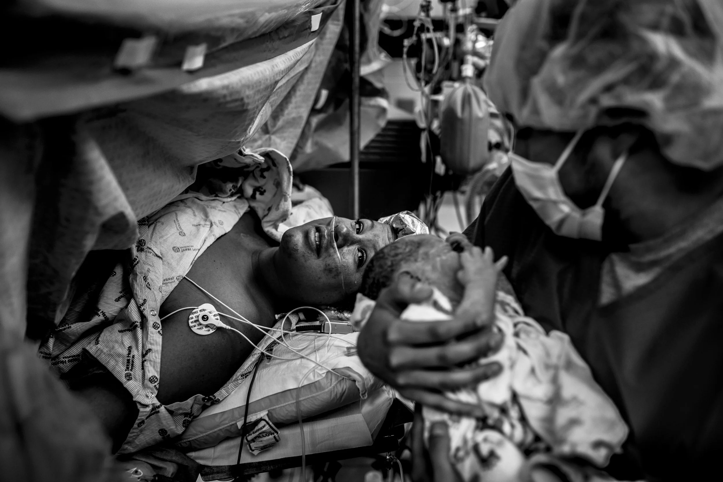 c-section photography